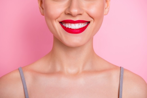 Benefits Of Dental Veneers