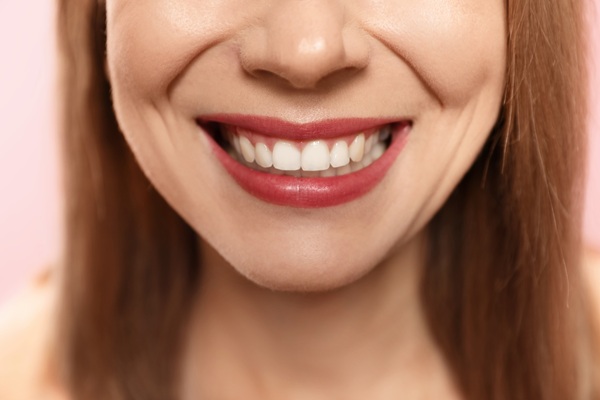 What To Expect After Implant Restoration