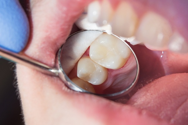 Oral Care Tips To Avoid Needing A Tooth Filling